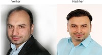 about